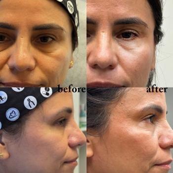 Regenerative Arts Anti Aging Center