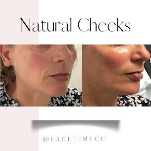 Face Time Aesthetics