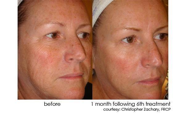 Theresa M Setter - Revitalize! CNY