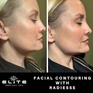 Elite Medical Spa of Parrish