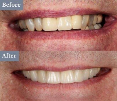 Precision Dentistry of Howard