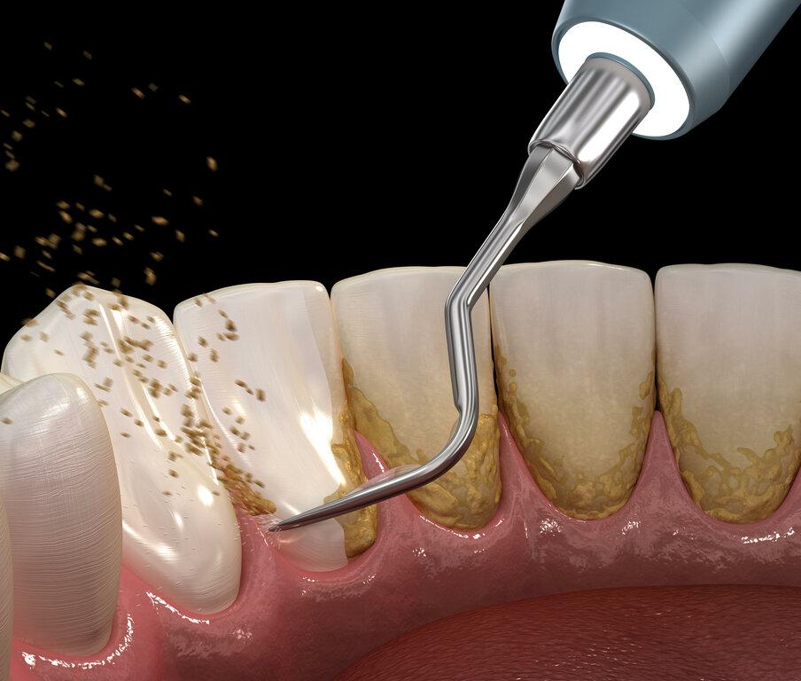 Smile Perfection Dental & Braces of Boynton Beach
