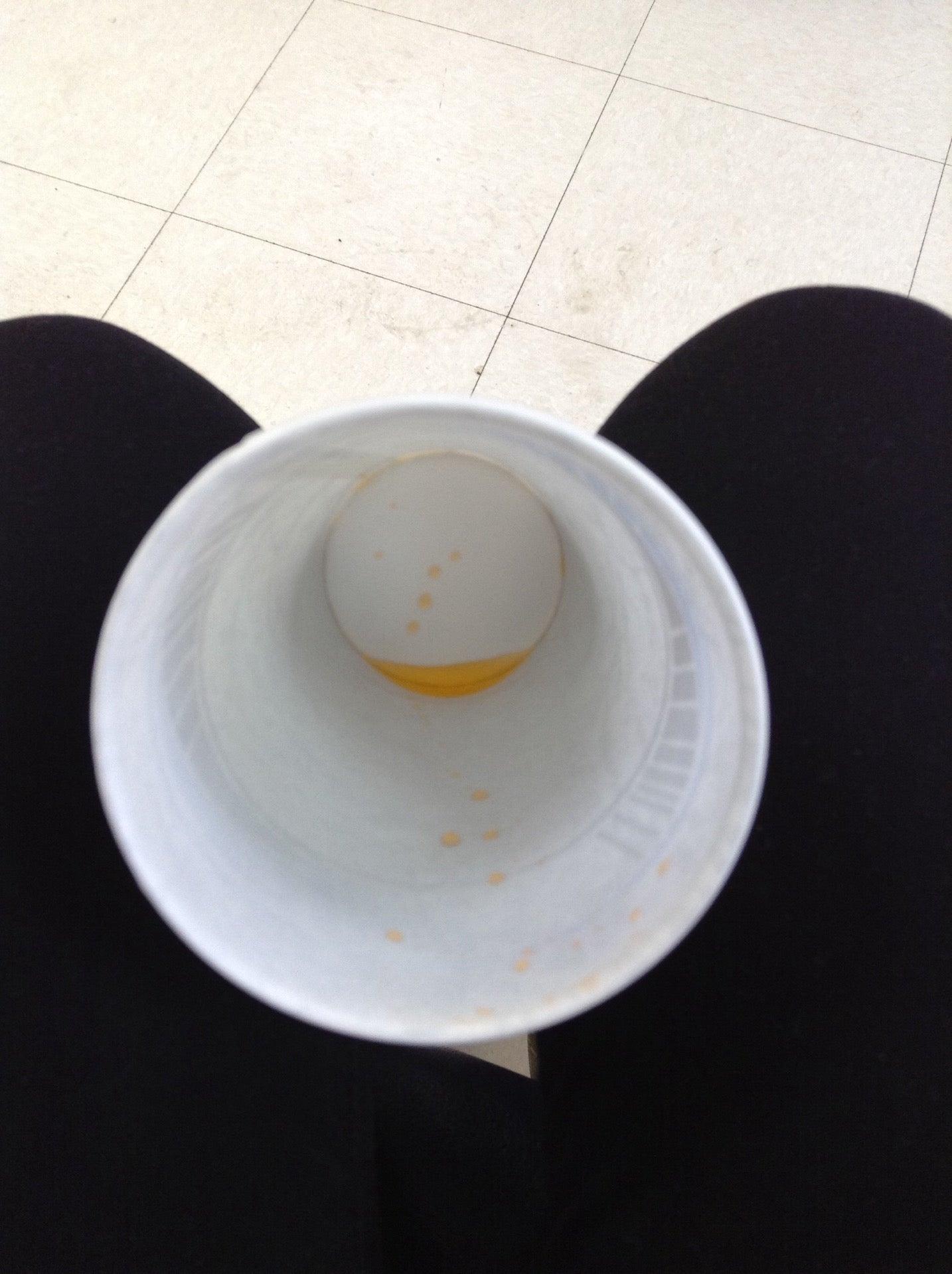 Calgary Laboratory Services