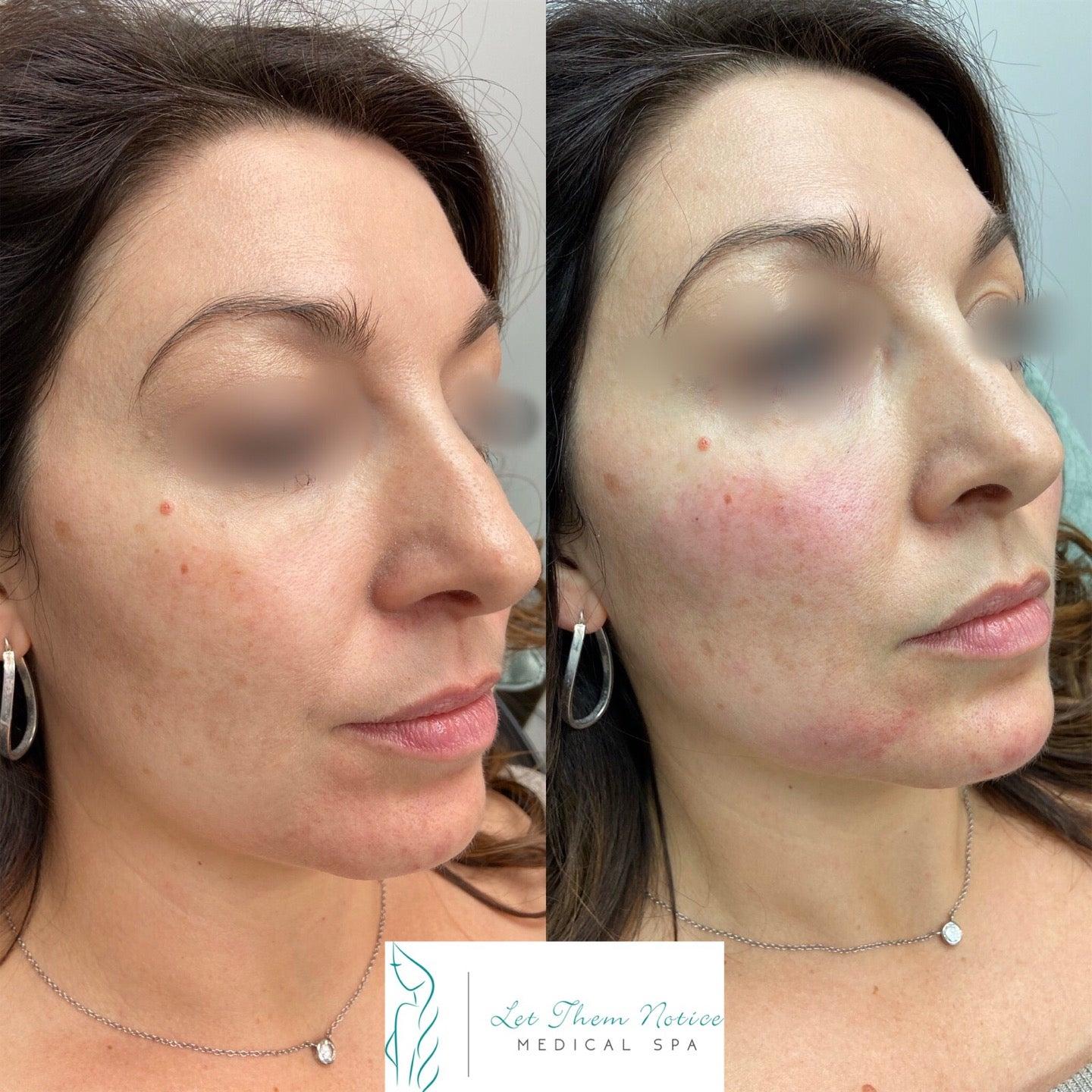 Let Them Notice - Botox Clinic