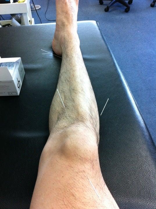 Rosedale Physiotherapy & Sports Injury Centre