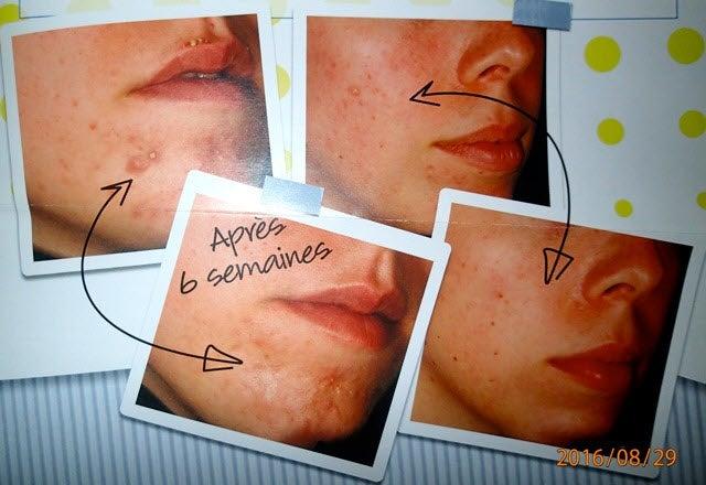 Institute Josée Aumais