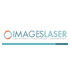 Images Laser