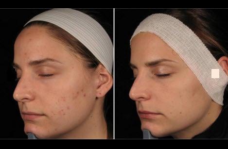 Rejuvenation Makeup and Laser Clinic