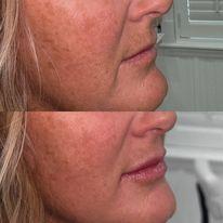 Aesthetic Skin Studio of Clearwater