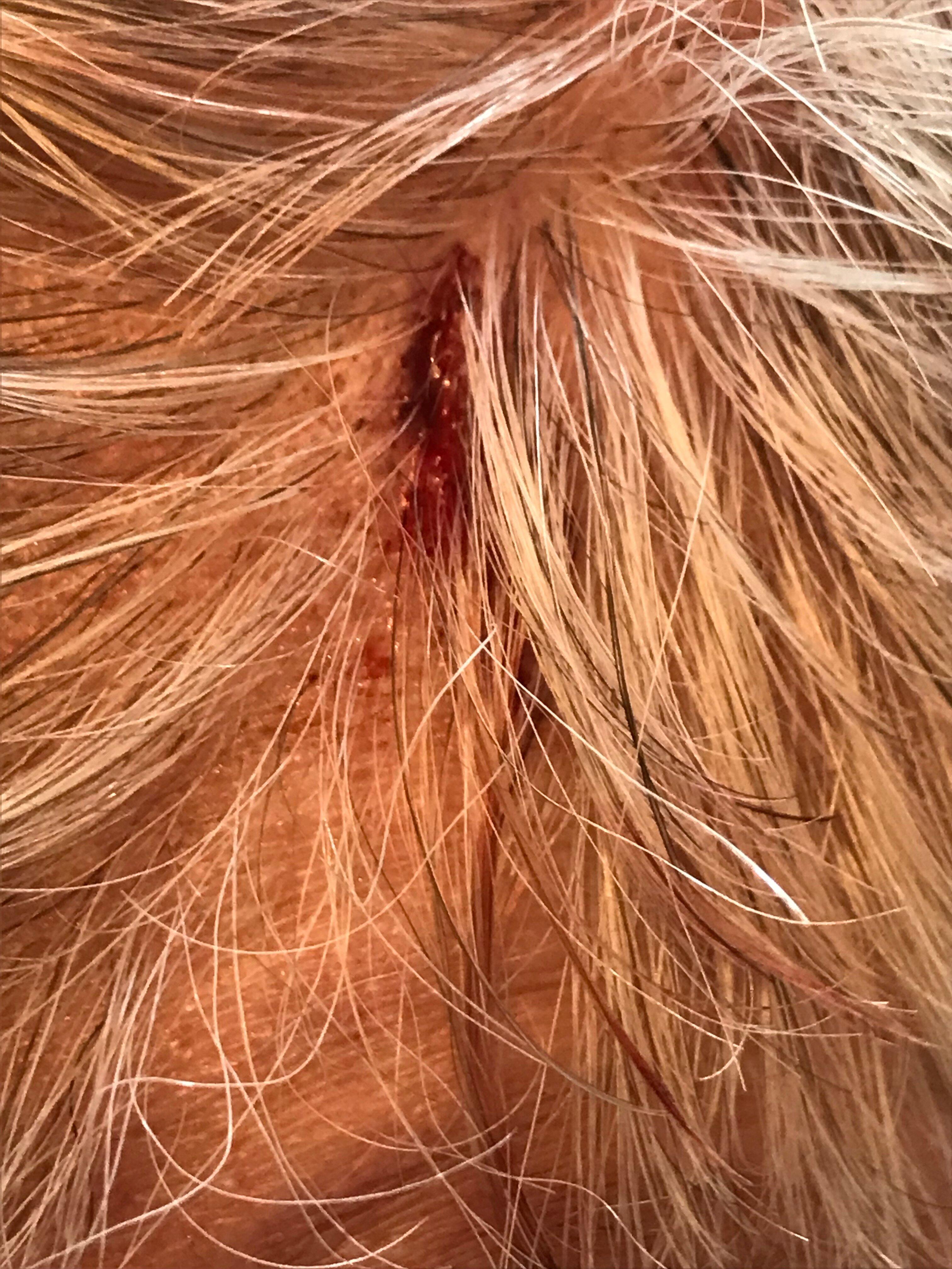 Easirent. Dublin Airport