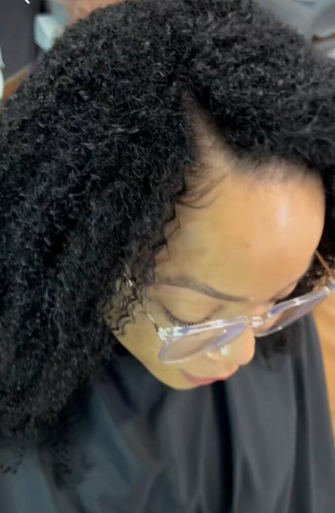 NHCG Trichology-Hair Restoration & Head Spa