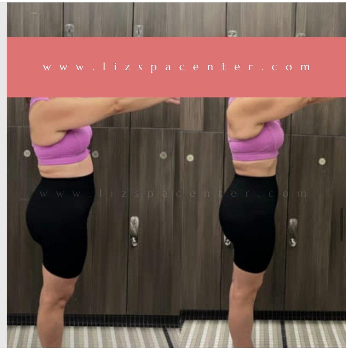 Photo by LISBANIA DEL CA... S