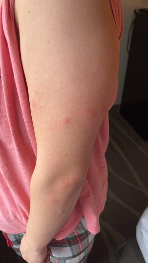 Best Western Plus Denver City Hotel & Suites