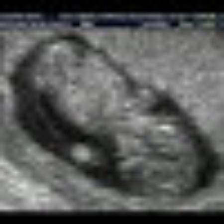 photo of ignaciol504