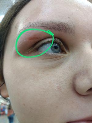 This happened during a eyebrow wax wtf Happened at the zero Walmart location today