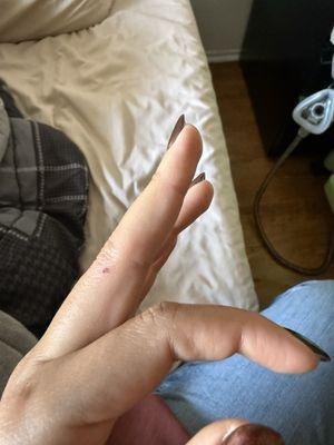 They tried to remove these stains with a nail FILE!!!!!