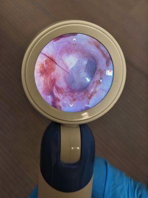 Ascent Audiology & Hearing