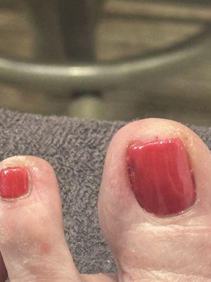 It looks like a 5 year old pained my skin, oops, I mean nails.