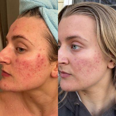 Laurel Clement Aesthetics