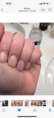Damage to cuticles, Wide nail shaping