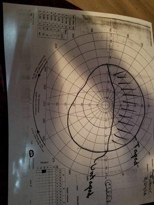 This is my eye test, i found another caring dr. that will do another in Jan. when i post lets see if Sara K lied or not. Its all about $$$
