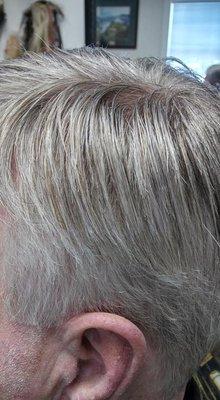 Avanta's Hair Restoration