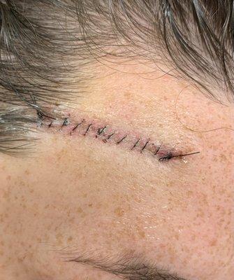 Dermatology of Bellevue