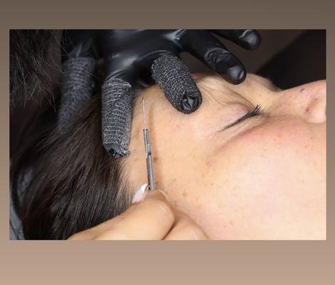 Dermaplaning Facial