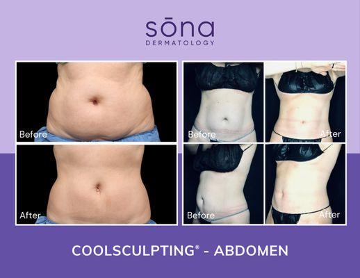 Sona Dermatology of Greensboro