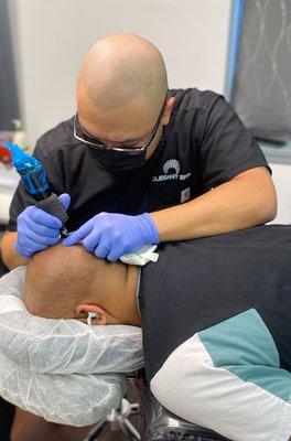 Elegant Scalp Micropigmentation