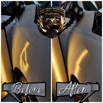 Pao Dent Removal