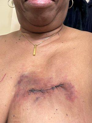 Lexington Plastic Surgeons