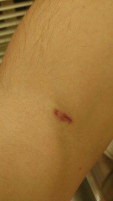 Central Coast Pathology Patient Service Center