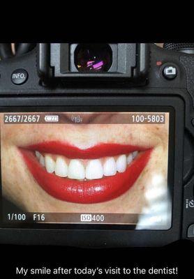 Hirsh Leslie Stone, DDS