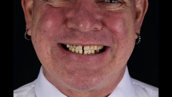 Smile Design Implant Centers