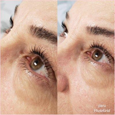 Lash lift