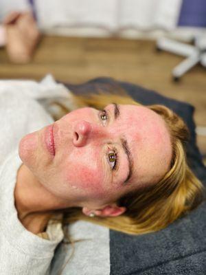 After lash lift & tint
And brow wax & tint