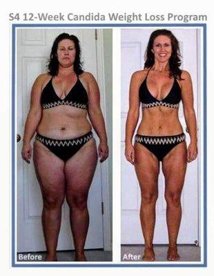 This could be you! Call Chase Club Reduce at (256)763-6373 TODAY to get started, because NOTHING tastes as good as thin and healthy feels!