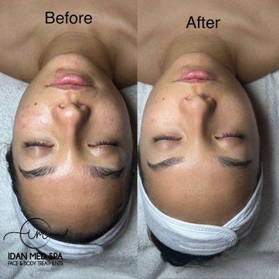 Idan Med Spa