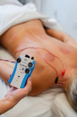 Electroacupuncture for fast and effective pain relief.