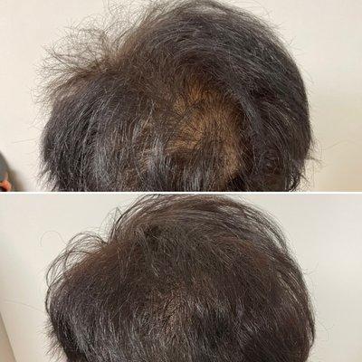 Havilah Hair Restoration