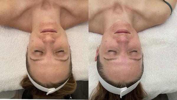 Caprice Beauty Aesthetic