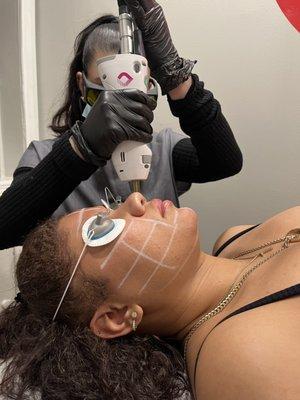 Own your beauty. Laser Genesis facial.
Can you level up!