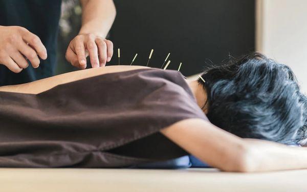 Miami Center for Acupuncture and Oriental Medicine