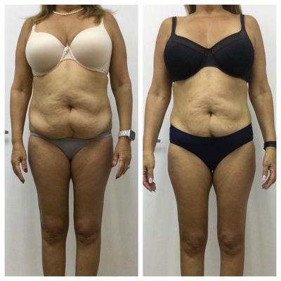 Evolution Rejuvenation