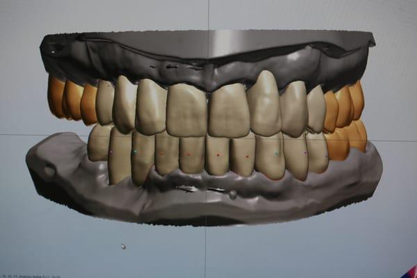 Digital Dentistry Experts