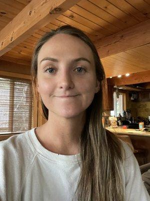 3 weeks post-op (after)