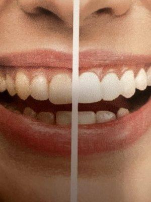 Lakewood Dental Center