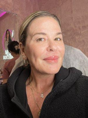 Her name says it all...THE BEST INJECTOR!!!