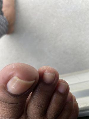 He cut my second toenail way too far back and nipped the top of my toe